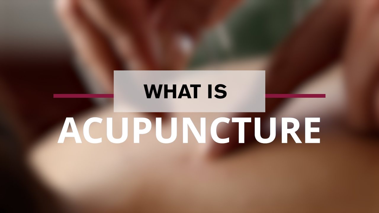 Demystifying the Role of Acupuncture for Pain Management