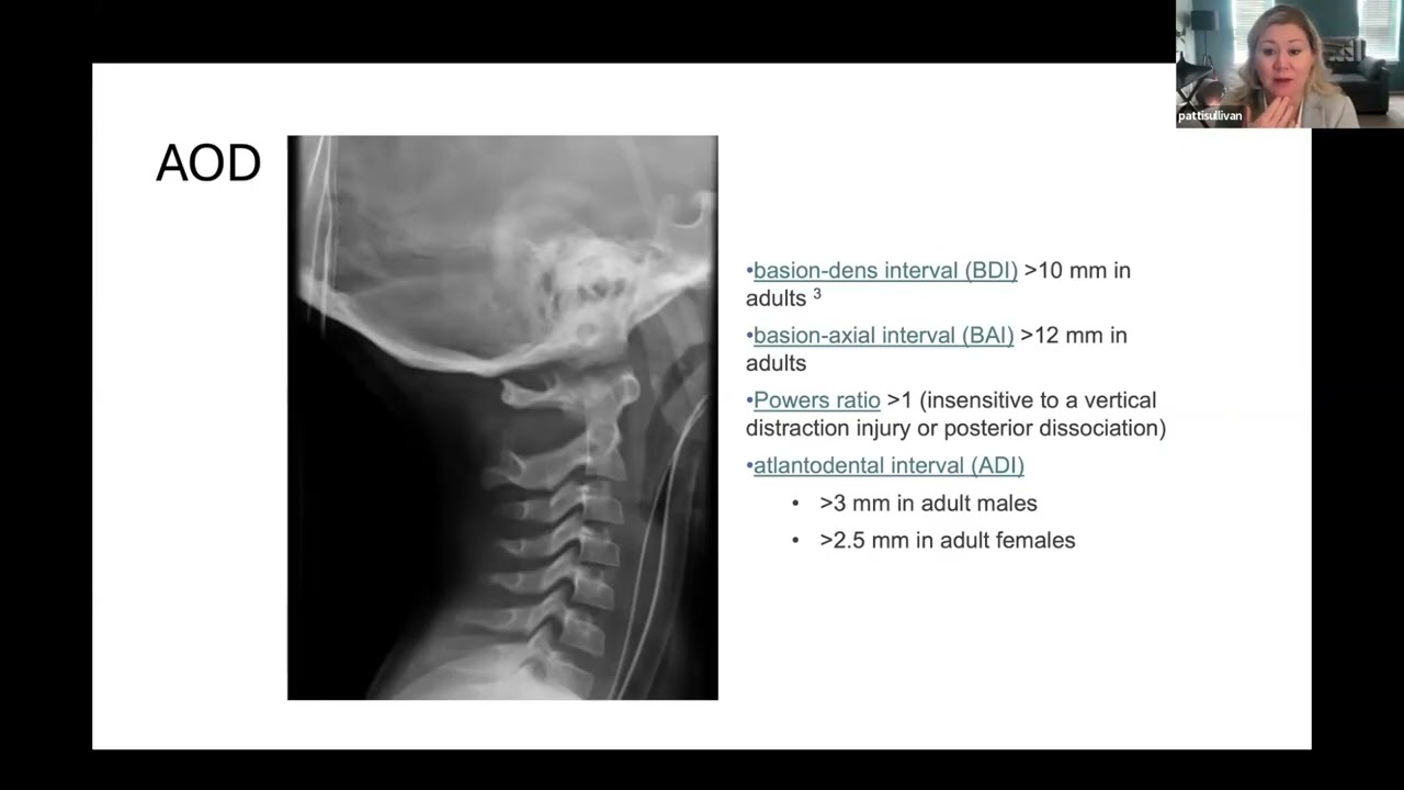 Chiari & CCI: Evolving Insights and Current Surgical Concepts with Dr. Patricia Sullivan