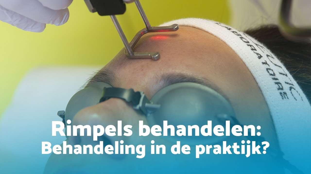 Hoe gaat de rimpel behandeling in zijn werk?