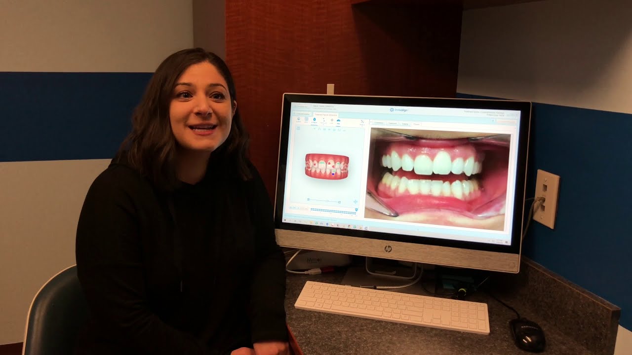 Happy Invisalign Patients at Stamford Dental Arts Ali Modiri DDS