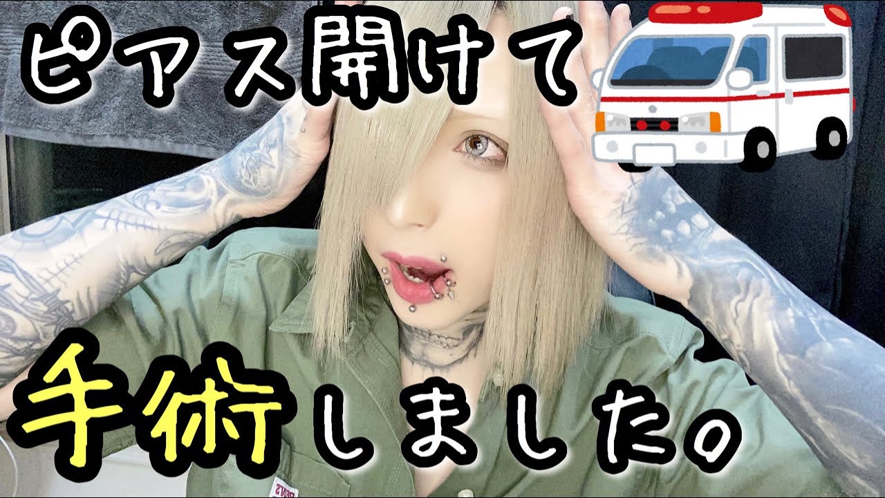 みんなも注意して！ピアス開けて手術したお話。