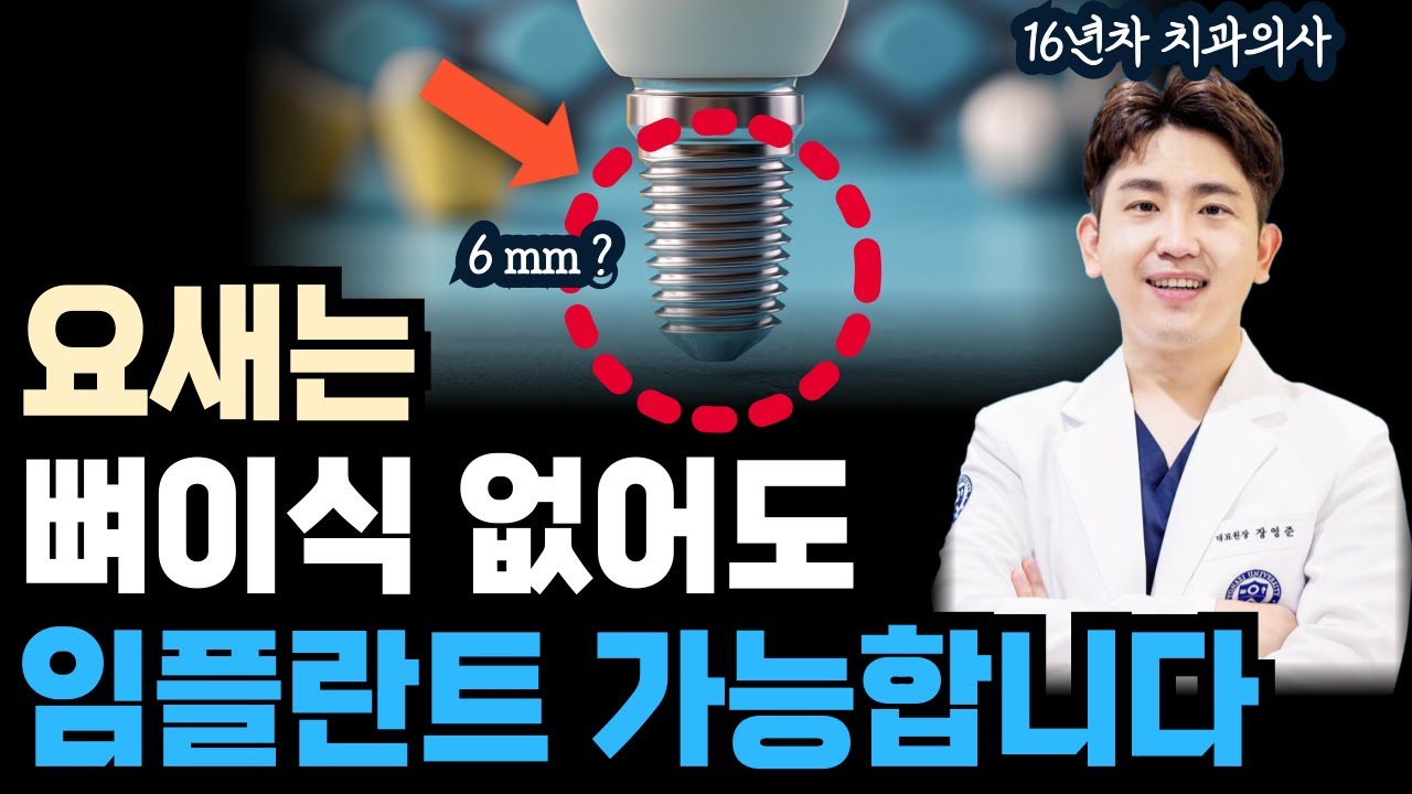 요새는 뼈이식 없어도 임플란트 가능합니다. #숏임플란트 #풀아치임플란트