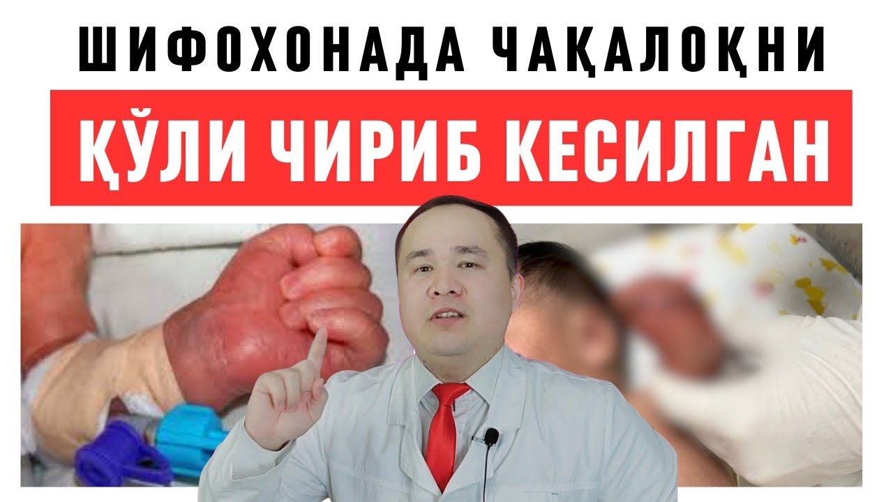 ШИФОХОНАДА ҚЎЛИ ЧИРИБ КЕСИЛГАН ЧАҚАЛОҚ | МУНОСАБАТ ИСЧАНОВ |СОҒ ҚЎЛ БИЛАН КЕЛГАН ҚЎЛСИЗ КЕТГАН ҚИЗЧА