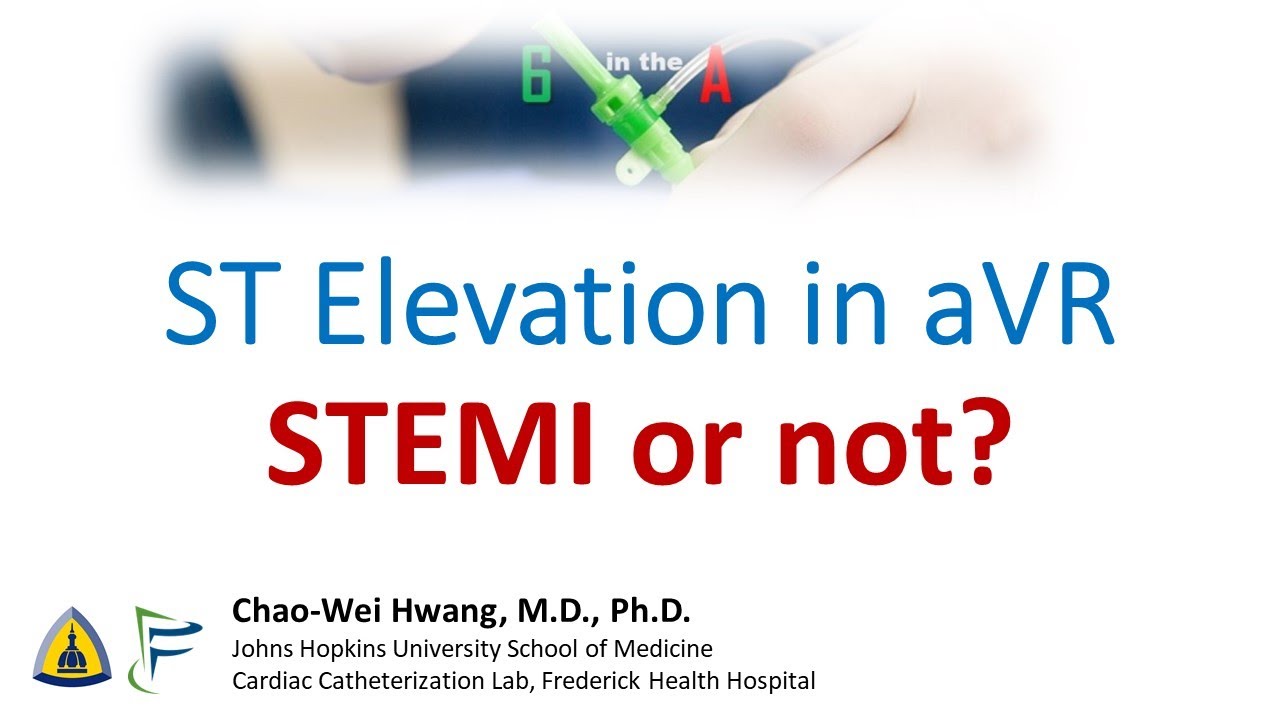 ST Elevation in aVR: STEMI or not?