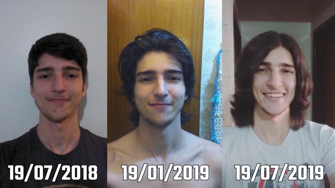 1 Year Hair Growth Timelapse