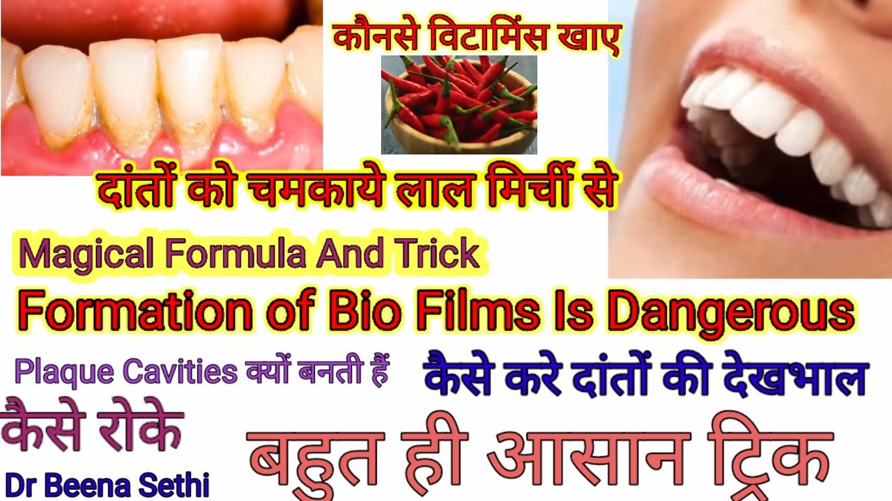Plaque Cavities  दांतों को  चमकाए Clear yellow bio film from teeth