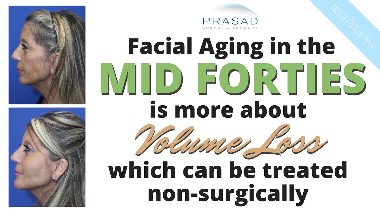 Anti-Aging Treatment in Mid 40s is More about Non-Surgical Volume Correction than Facelifting