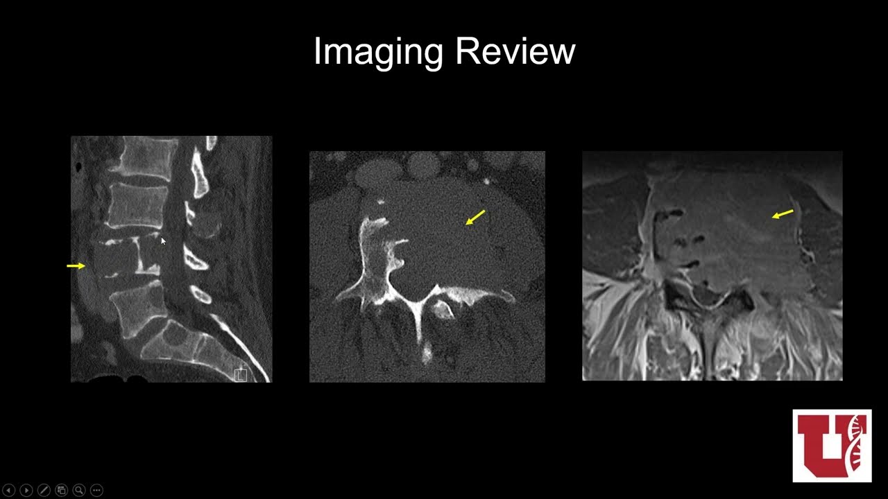 Procedures 101 for the General Radiologist - Course Sample