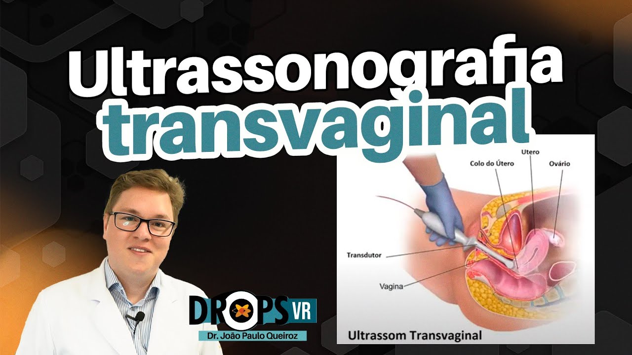 ULTRASSONOGRAFIA TRANSVAGINAL - DETALHES TÉCNICOS DE COMO REALIZAR O EXAME | VOCÊ RADIOLOGISTA