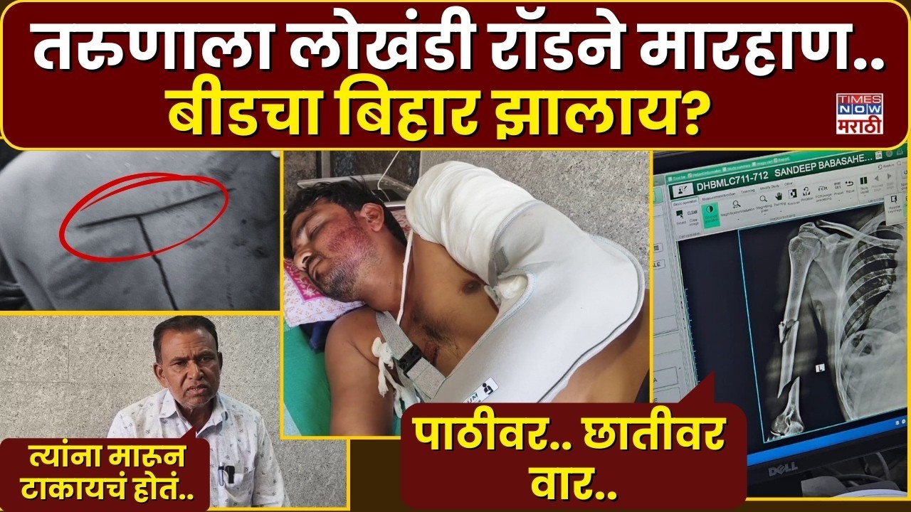 LIVE | Beed Crime News: तरुणाला लोखंडी रॉडने मारहाण..बीडचा बिहार झालाय? | Father Demands Justice