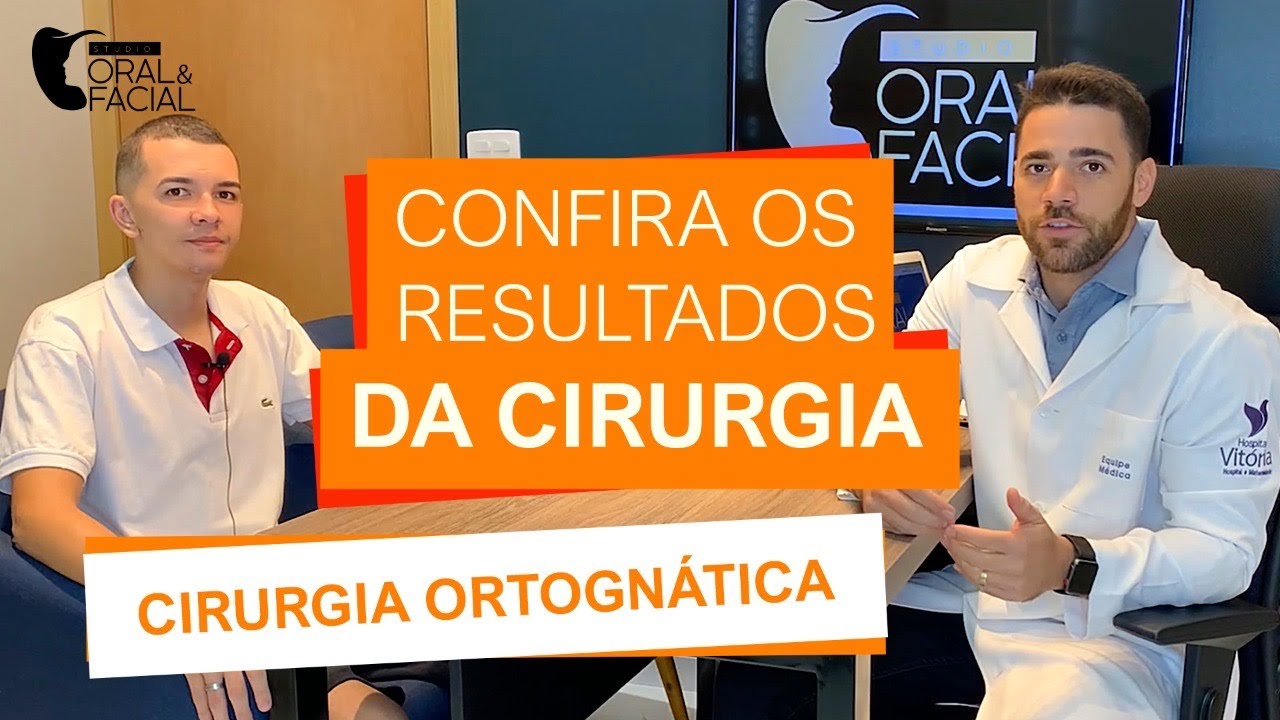 Depoimento Cirurgia Ortognática, Paciente Classe 2 + Invisalign (aparelho invisível) !