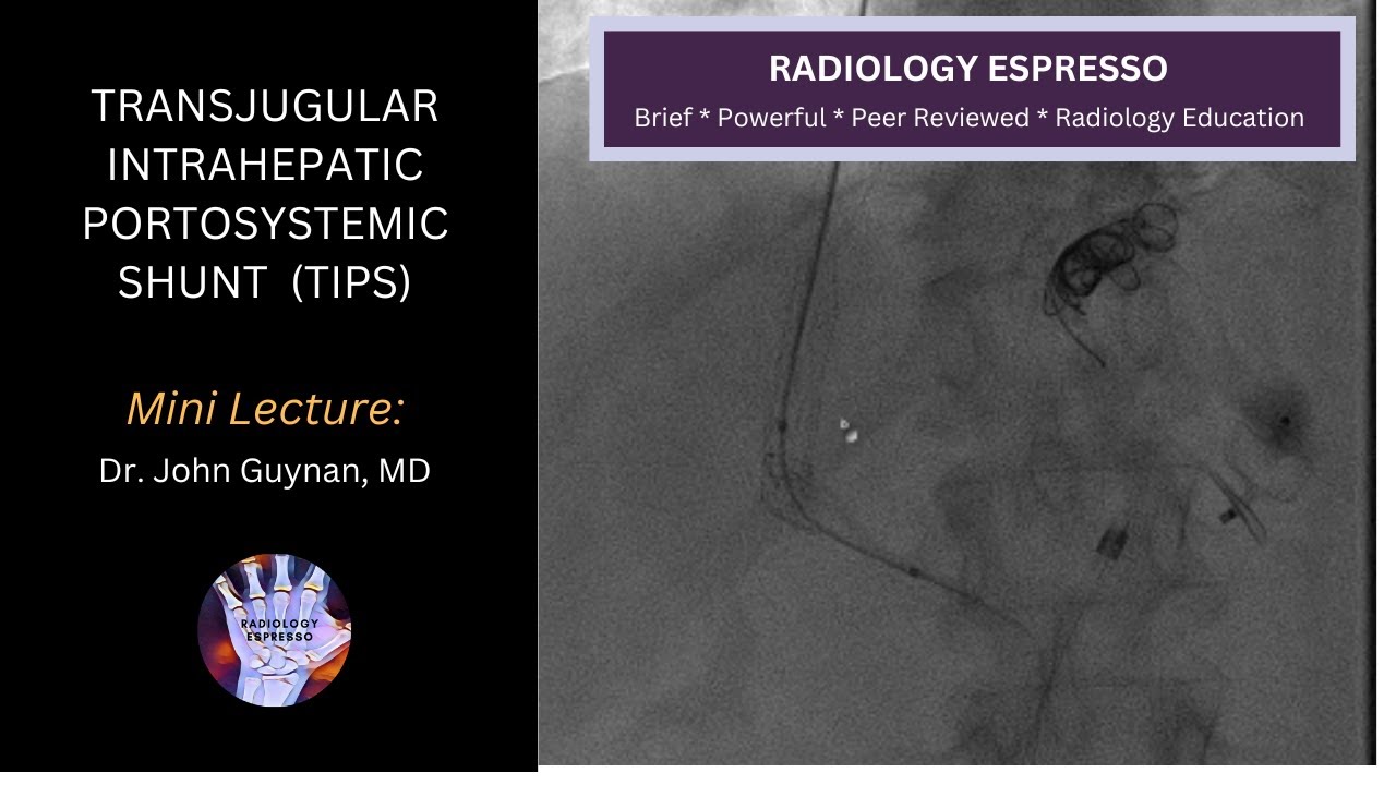 TRANSJUGULAR INTRAHEPATIC PORTOSYSTEMIC SHUNT (TIPS): Mini Lecture, Dr. John Guynan, MD