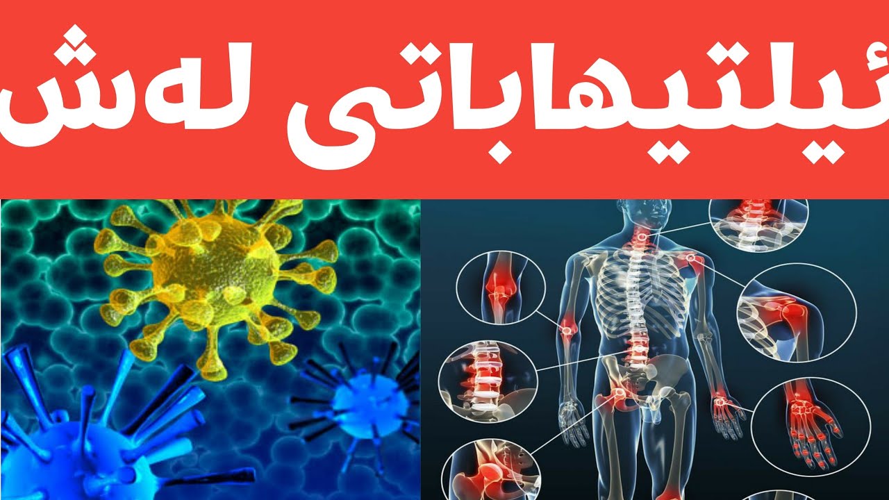 inflammation and infection...ئیلتیهابات،،