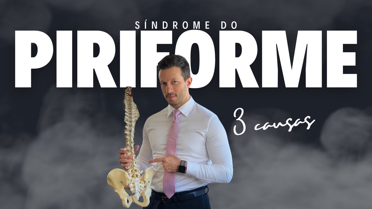 3 CAUSAS PARA A S&Iacute;NDROME DO PIRIFORME
