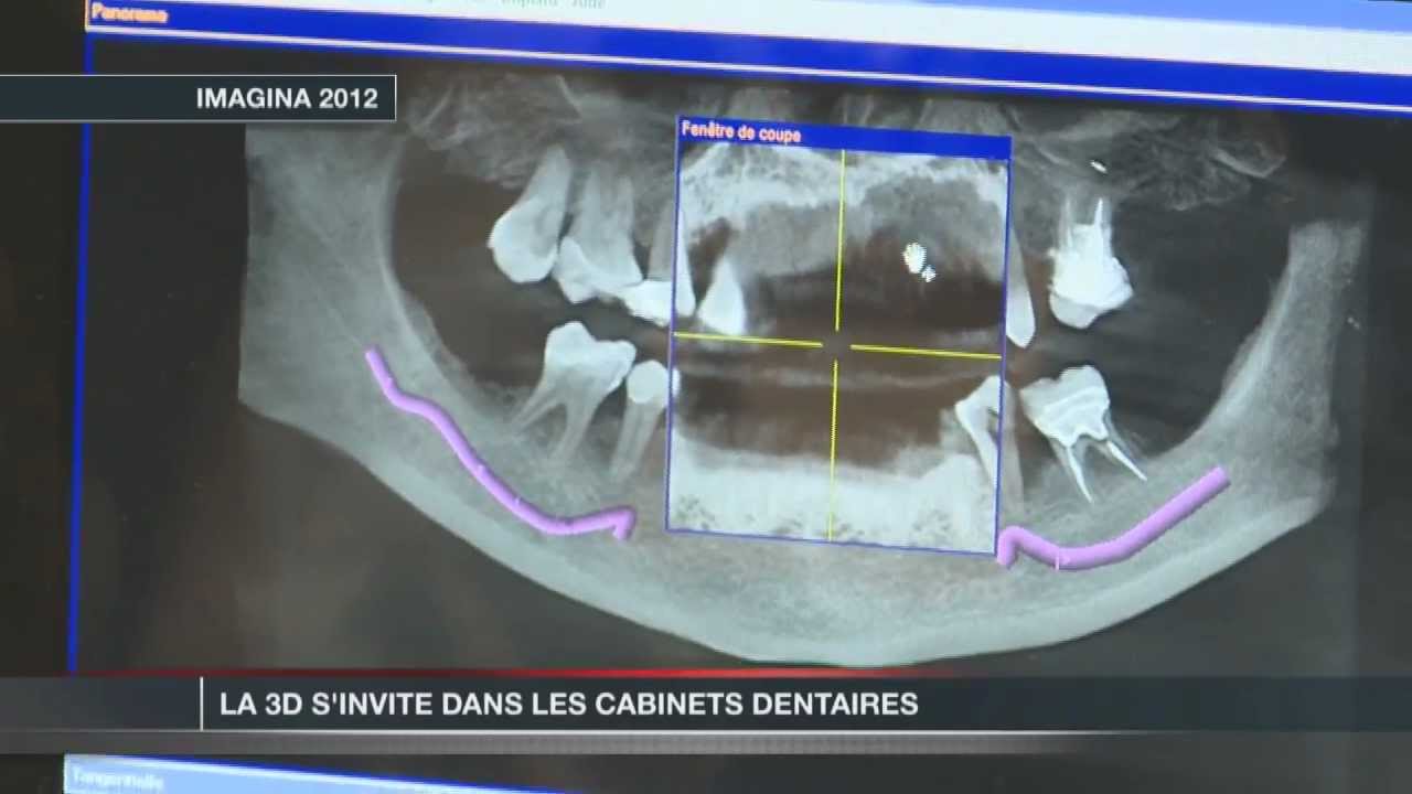 La 3D arrive chez votre dentiste !