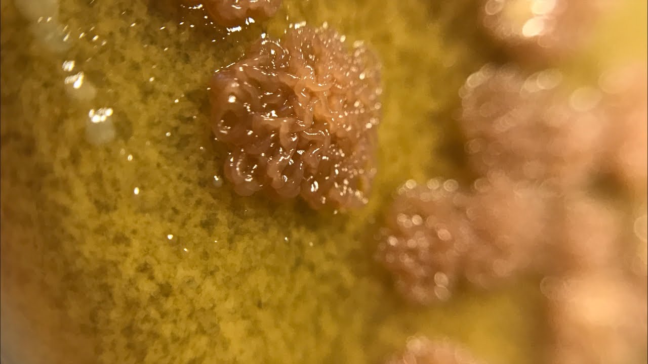 Редкий Pseudomonas / Citrobacter / Stenotrophomonas. Посев в баклаборатории. Особенности диагностики