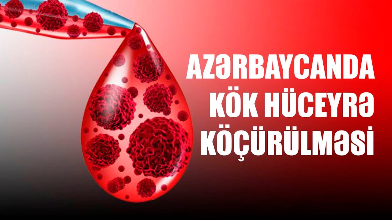 Azərbaycanda kök hüceyrə köçürülməsi
