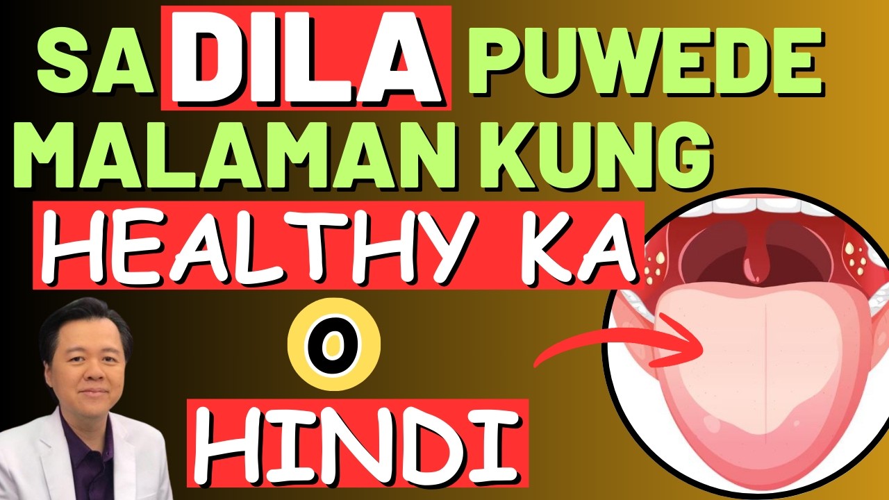 Sa Dila Pwede Malaman kung Healthy o Hindi. - By Doc Willie Ong (Internist and Cardiologist)
