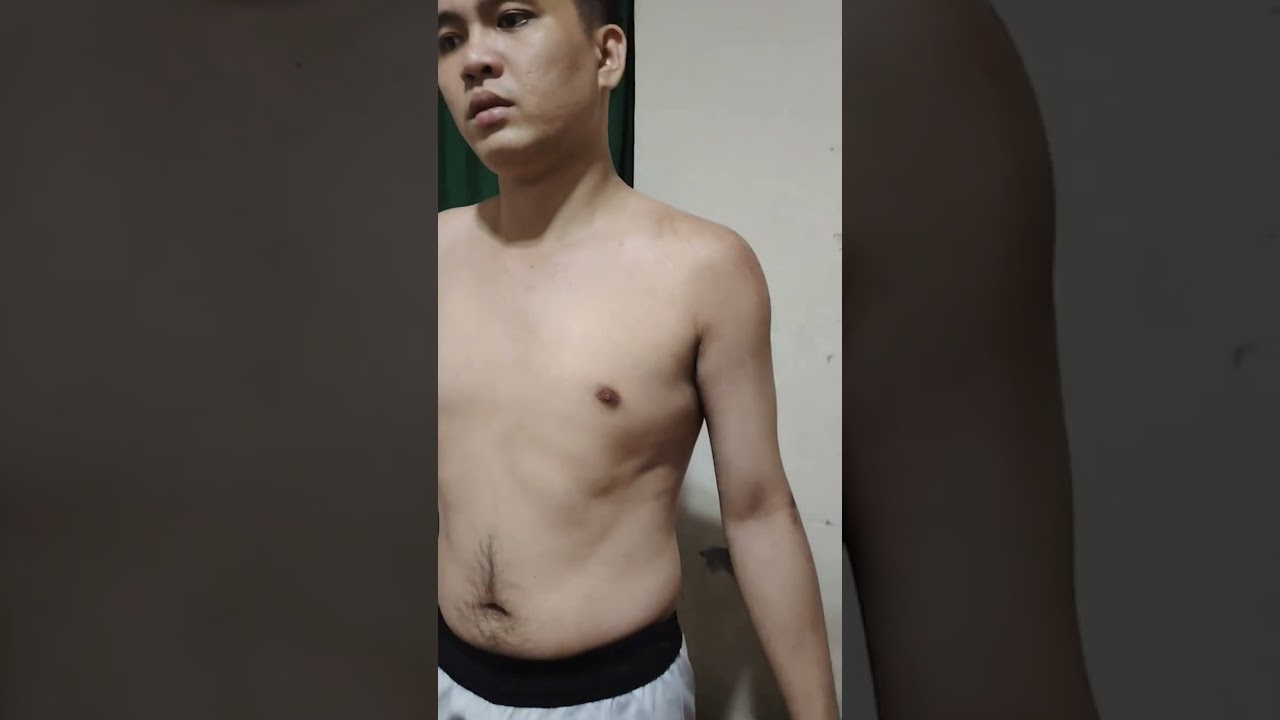 shoulder dislocated fixed