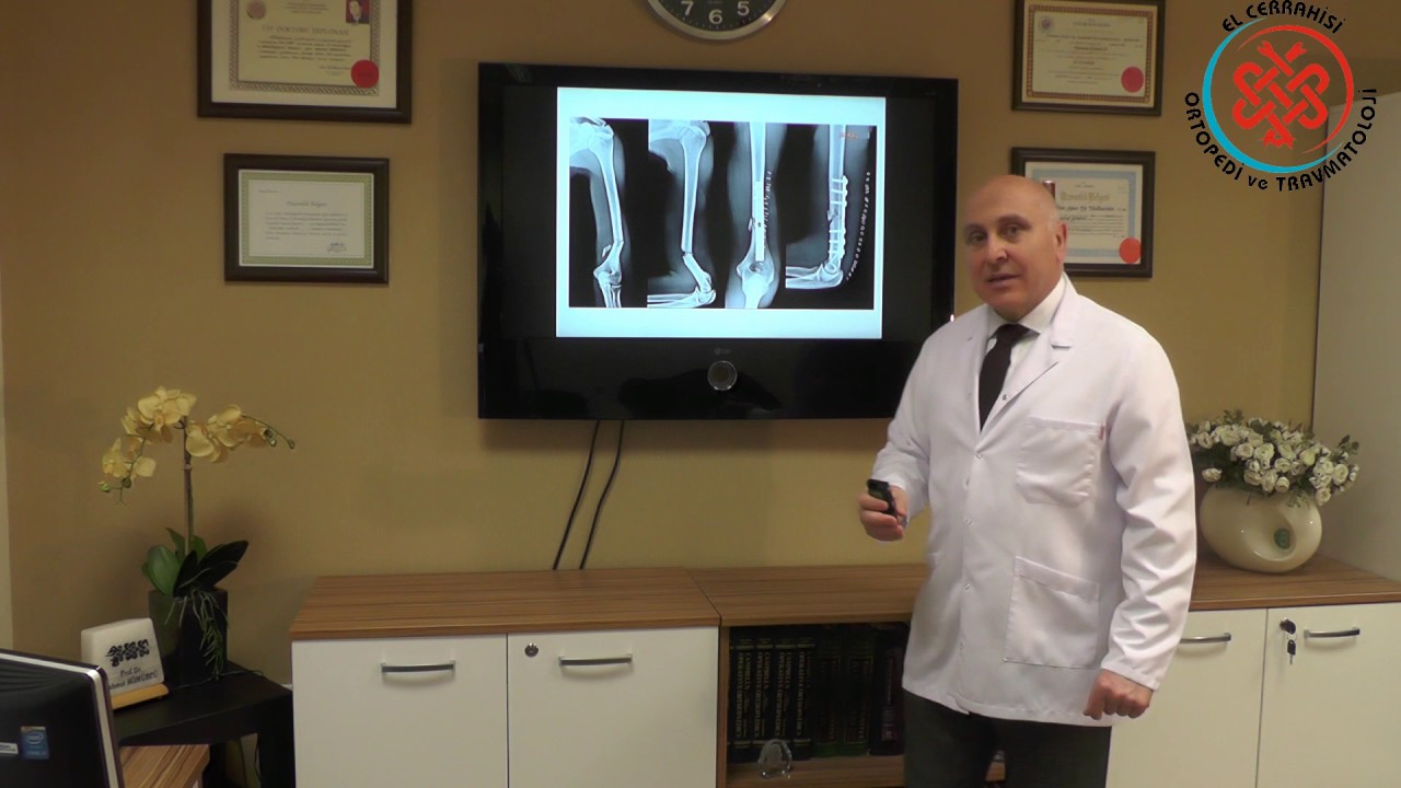 Humerus Kırığı Nedir