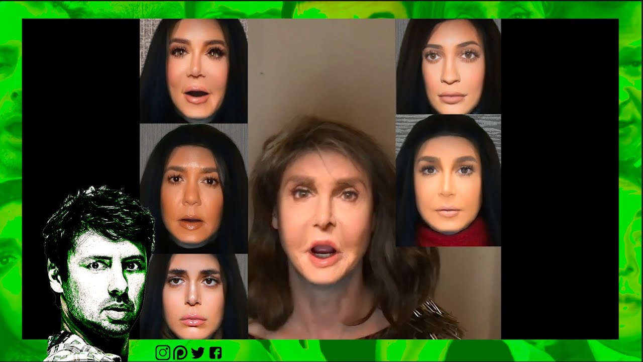 KARDASHIAN FACE SURGERY PROBLEM