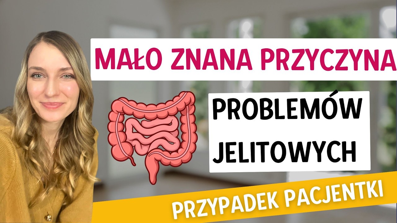 Dziwna przyczyna problemów jelitowych (i nie tylko). To nie SIBO ani IBS! To nietolerancja histaminy
