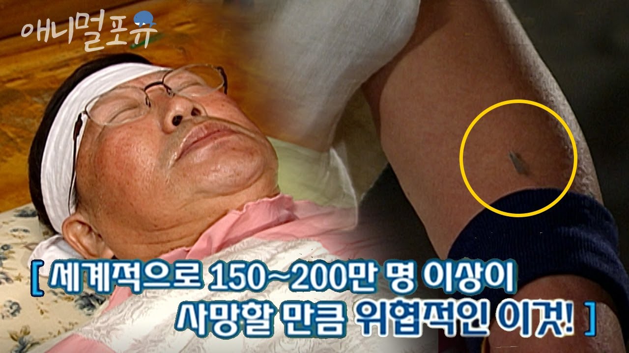 건강했던 사람들을 갑자기 사망하게 한 이것??? l KBS 위기탈출 넘버원 080526 방송