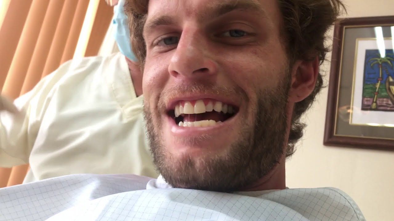 DENTAL WORK IN SAN JOSE COSTA RICA | ROOT CANAL CROWNS DENTAL IMPLANTS AND MEDICAL TOURISM.