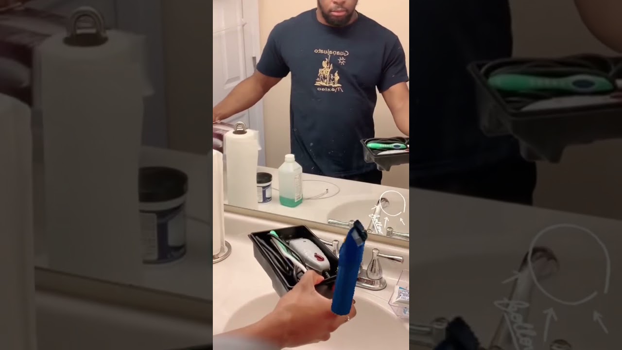 Being Bald in Your 20s