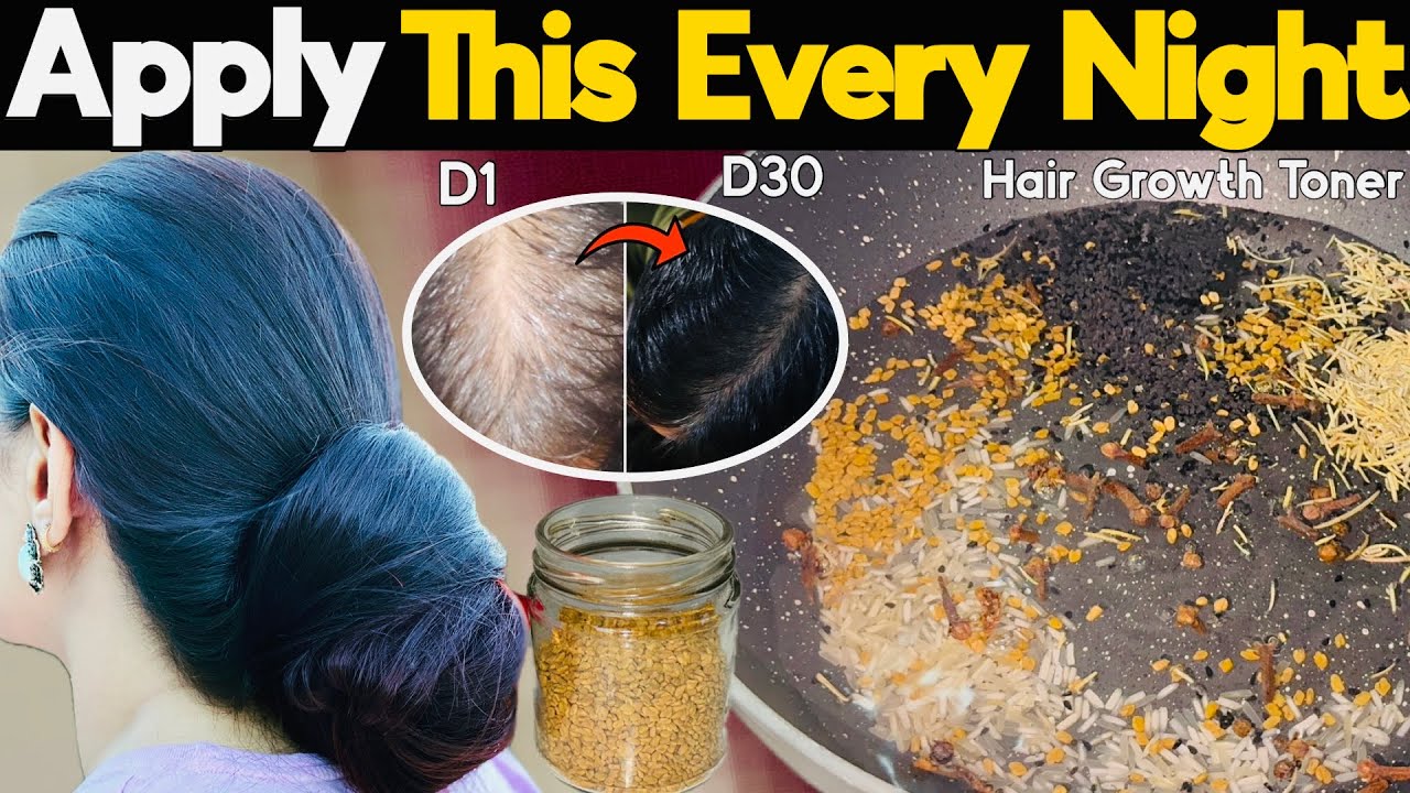 30 Days Challenge : कितने भी पतले कमजोर झड़ते बाल हों, इस Hair Toner से उगेंगे दोगुनी तेजी से बाल❤️