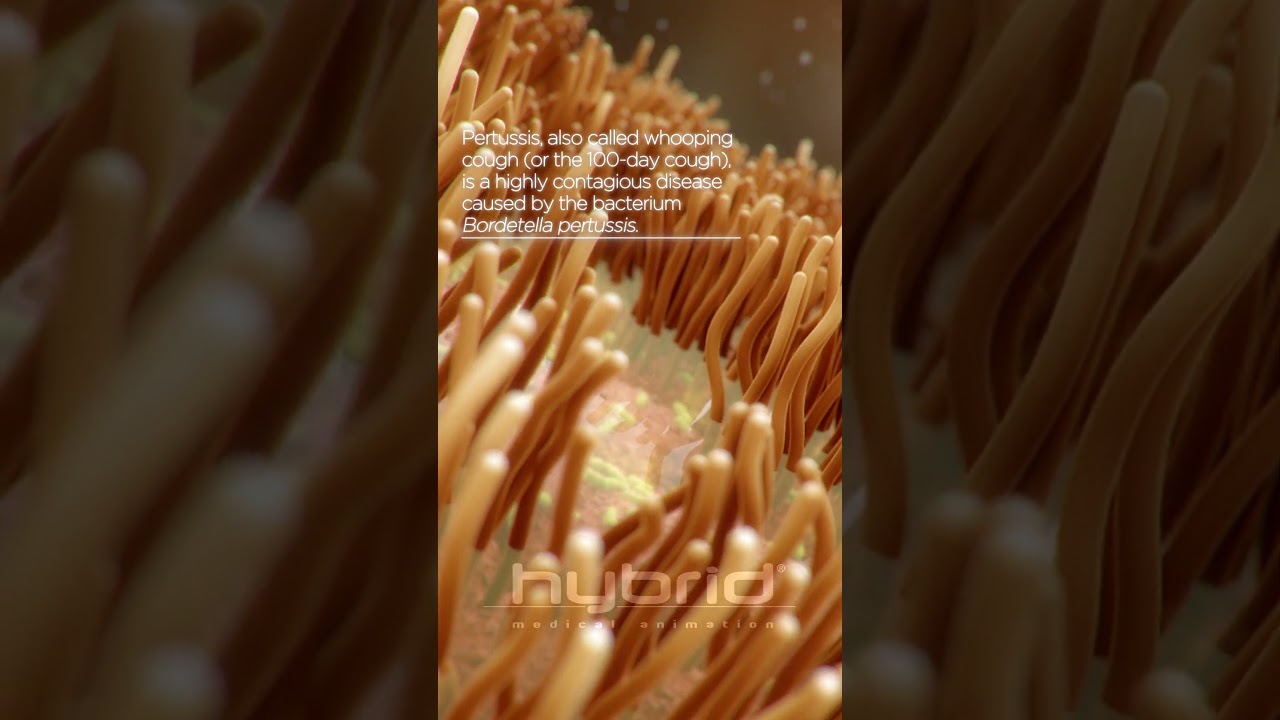 Whooping cough animation | Bordetella pertussis | 100-day cough | Pertussis animation
