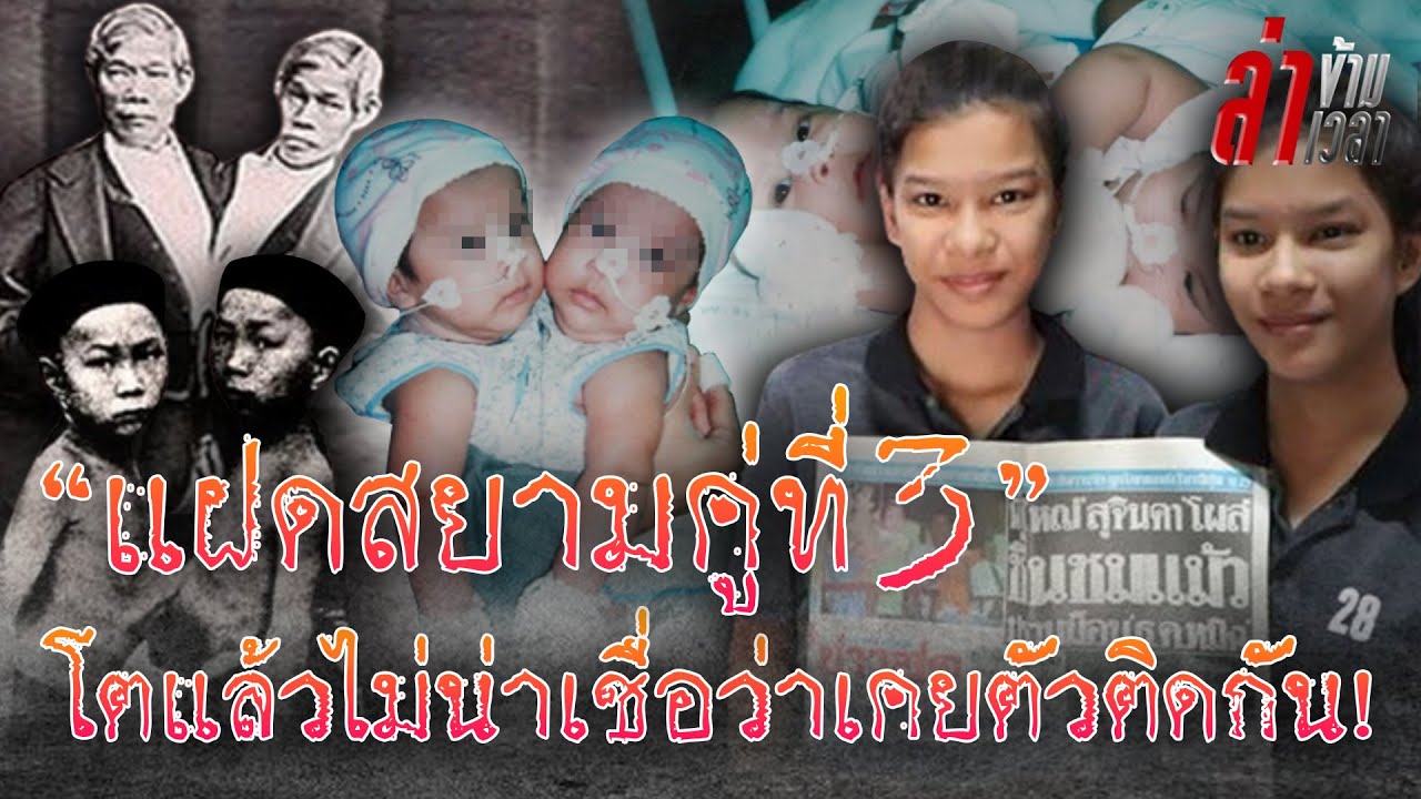 เปิดชีวิต 