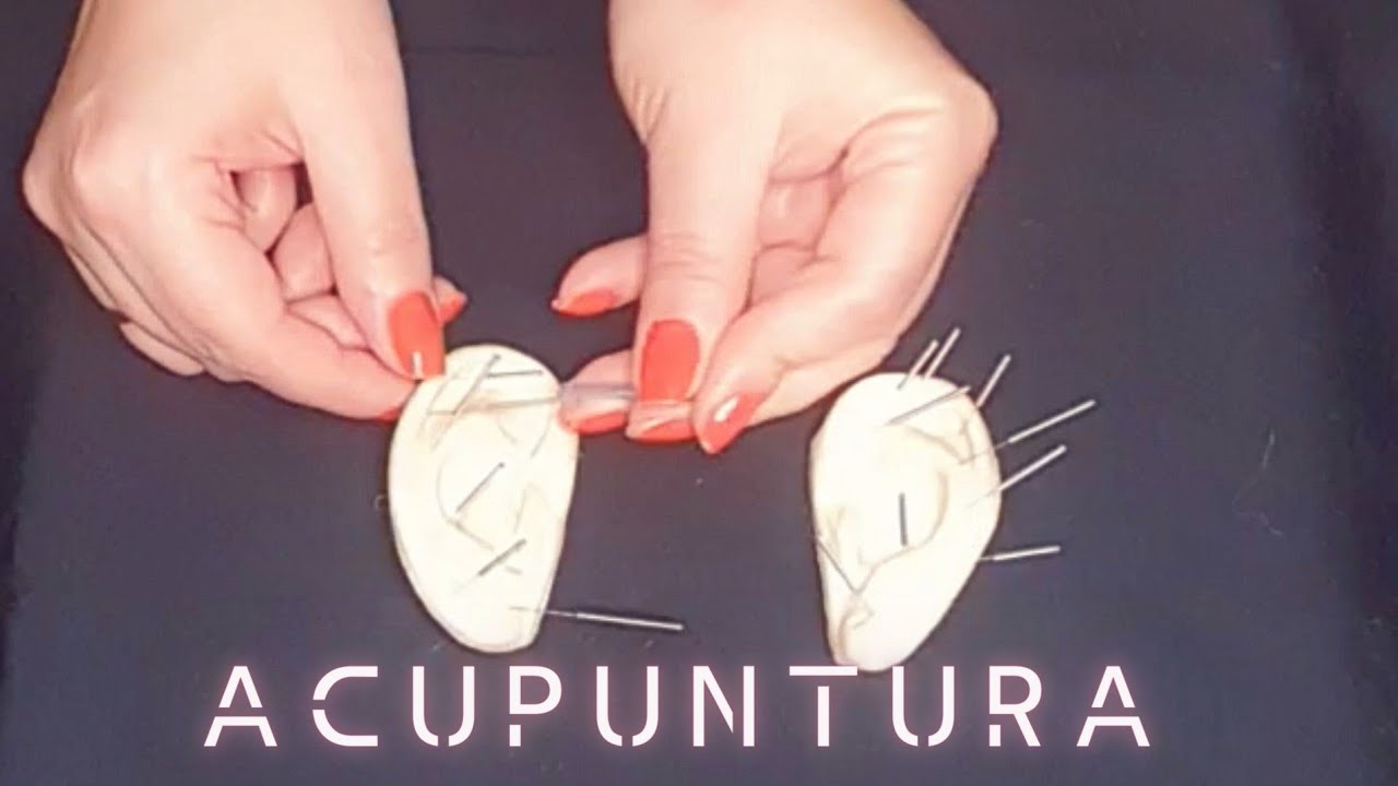 ASMR ☆ FAZENDO ACUNPUNTURA EM VOCÊ