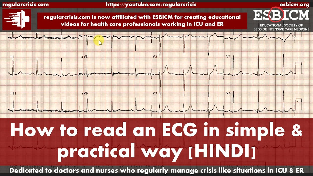 How to read an ECG in a simple and practical way | HINDI | RegularCrisis