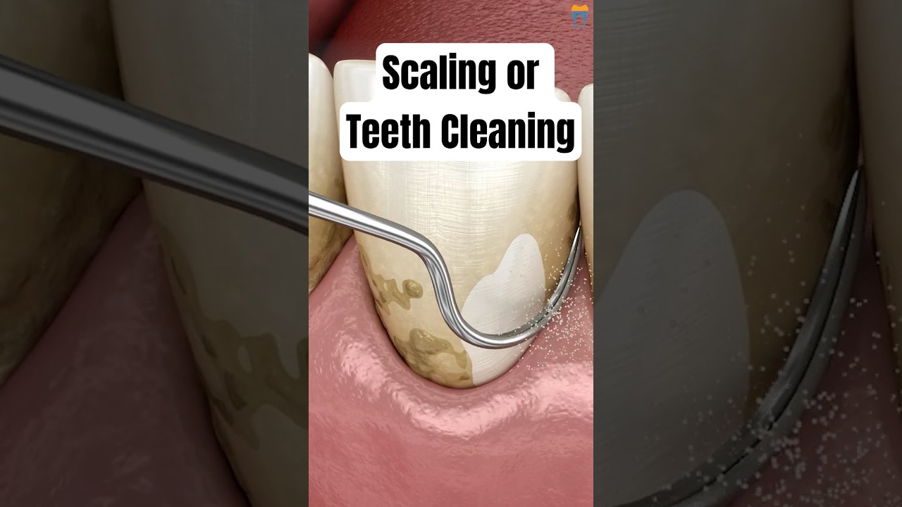 3 Best Scalers Every Dentist Should Have! #shorts #teethcleaning #teeth #viral