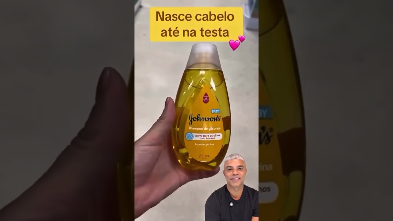 Acabe com a queda de cabelo e caspa com essa dica! #cabelo #dicas #calvicie calvic