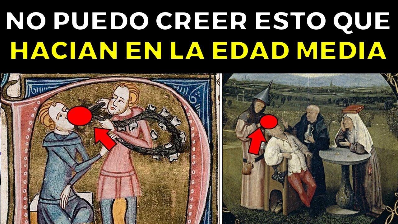 Esto era lo MÁS HORRIBLE de la MEDICINA en la Edad Media