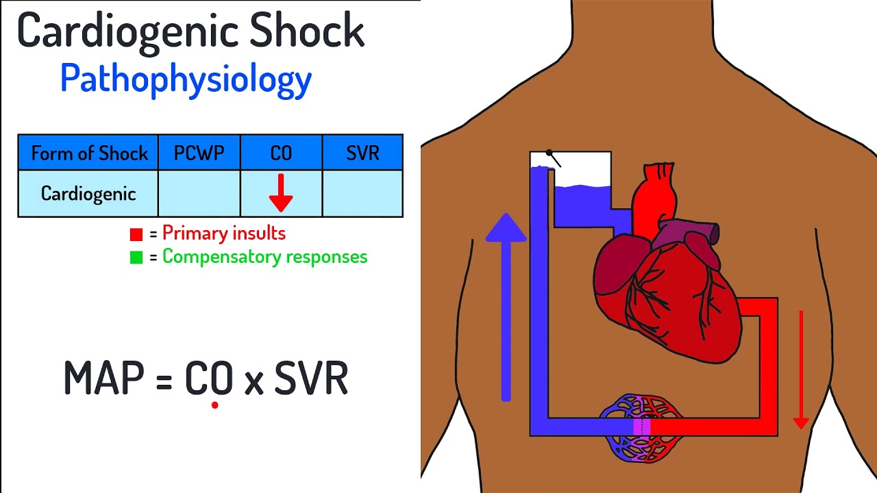 Shock