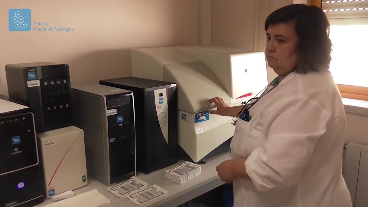 Serviço de Anatomia Patológica do CHCB - Vídeo de apresentação