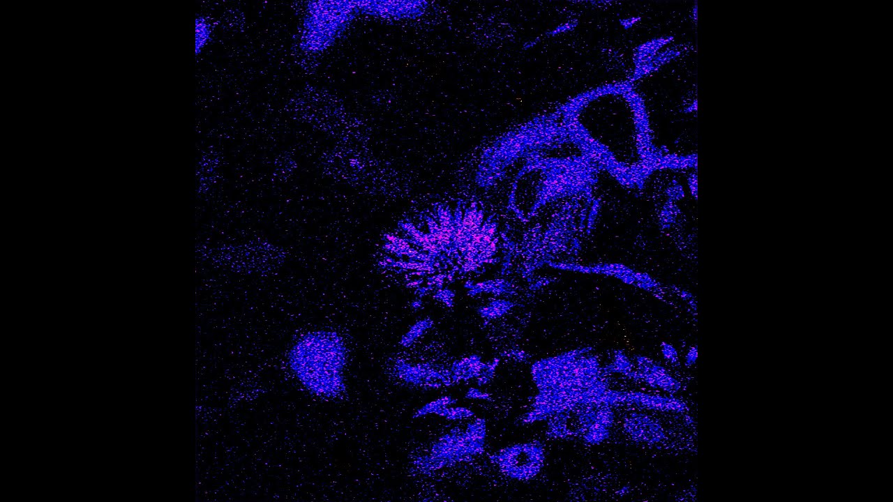 L1lly - Story of the lone Daisy (analogue)