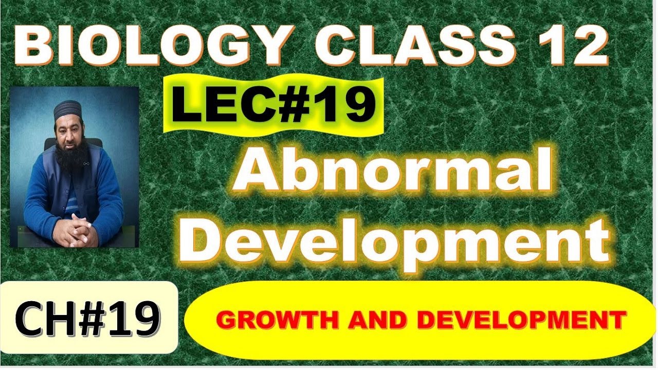Abnormal Development I Chapter 19 I I Growth and Development I Lec# 19