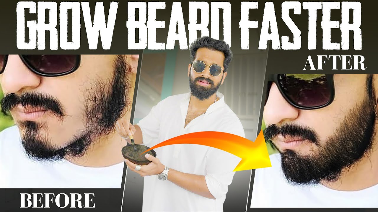 5 Ways To Grow *PATCHY BEARD* For TEENS