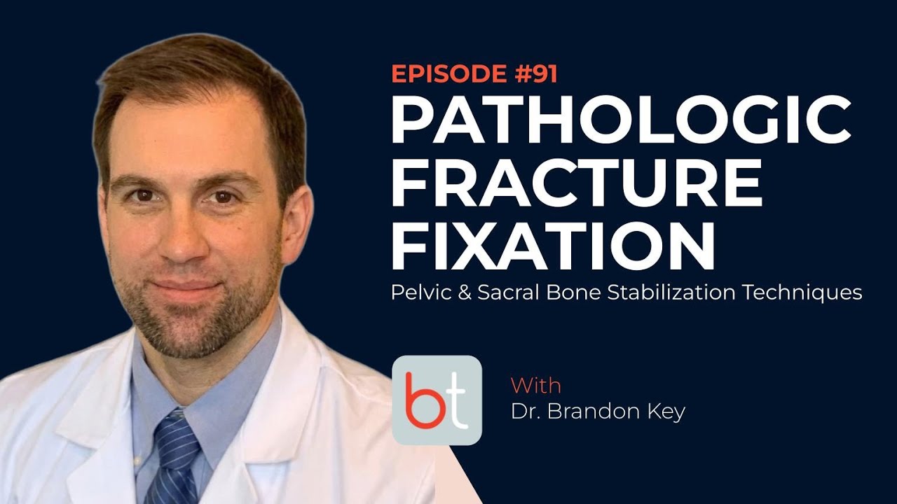 Pathologic Fracture Fixation: Pelvic & Sacral Bone Stabilization Techniques w/ Dr. Key | MSK Ep. 91
