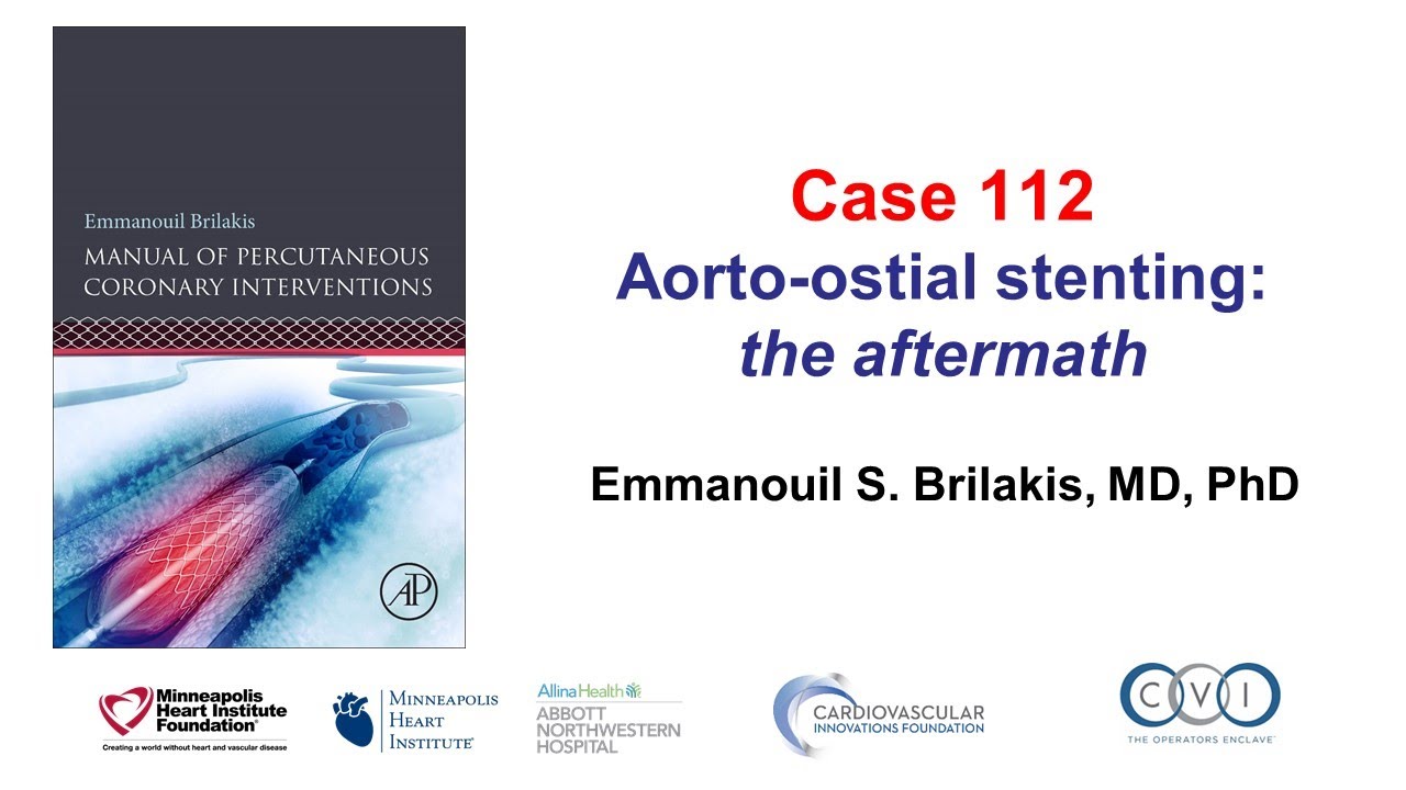 Case 112: PCI Manual - Aorto-ostial stent challenges