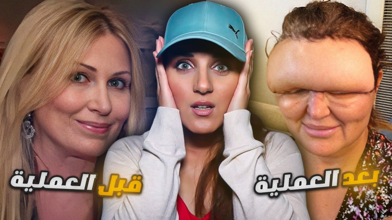 تحولت من اجمل عارضة ازياء في العالم الى ابشع فتاه في العالم 😱 القصة المرعبه لكارول براين 😞