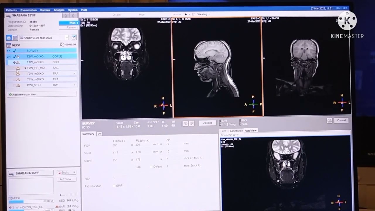 CEMRI Face+Neck planning and positioning  #mri #philips 3T