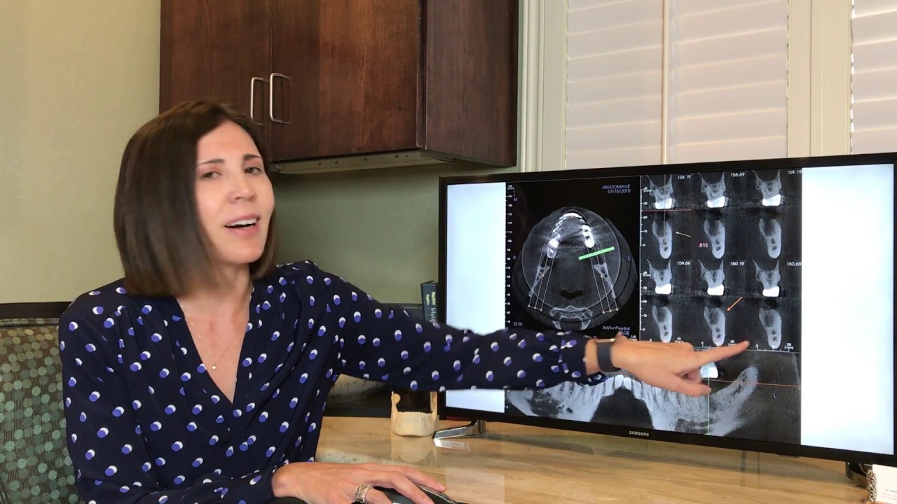 Dental Connection to Whole Body Wellness - True Holistic Dentistry