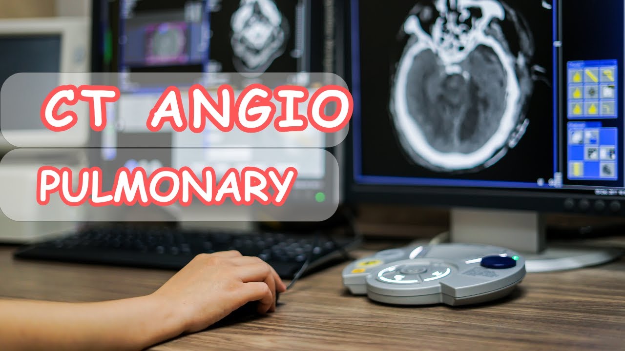 Ct angio pulmonary التصوير المقطعى لشريان الرئوى