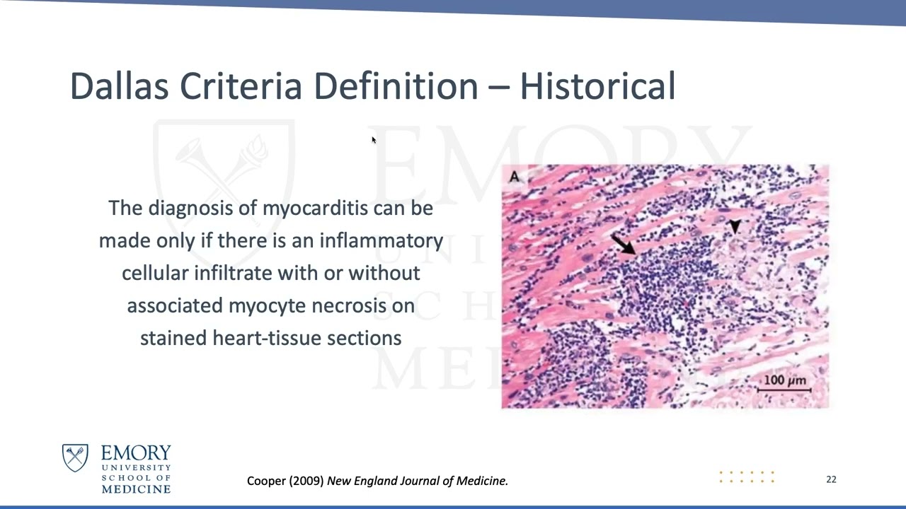 Hearts on Fire - Cases of Fulminant Myocarditis