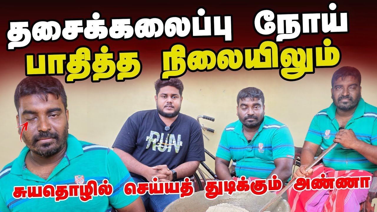 🆘️ கை கொடுப்போம் வாருங்கள்! ஜன அண்ணாவின் வாழ்வாதாரம் உங்கள் கையில்! 🙏| @BattiBoyz 